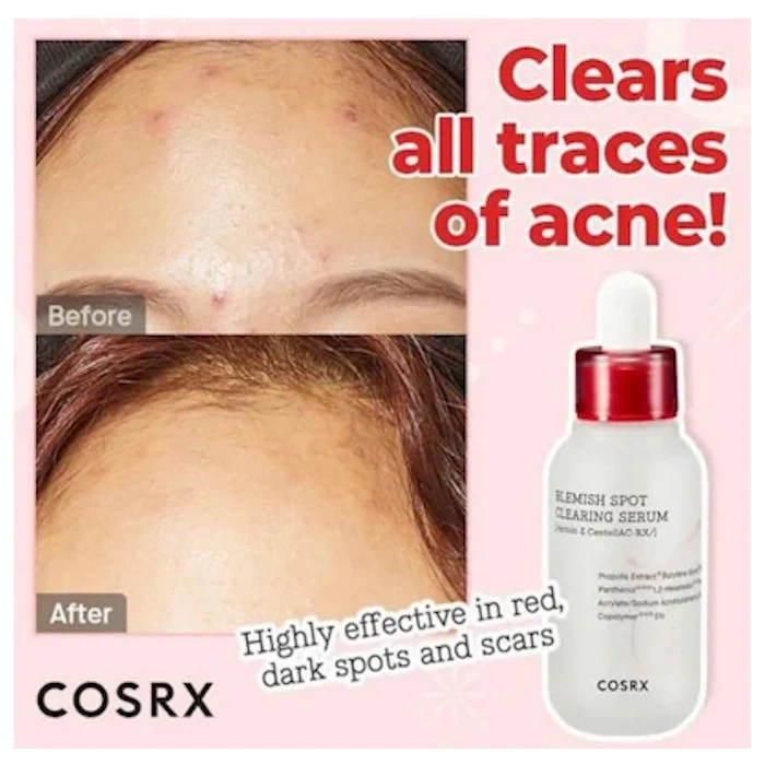 گالری تصاویر سرم ضد جوش و ضد لک کوزارکس