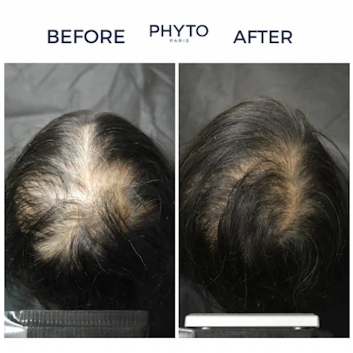 سرم ضد ریزش مو فیتو سیان مناسب خانم ها ۸۵ درصد