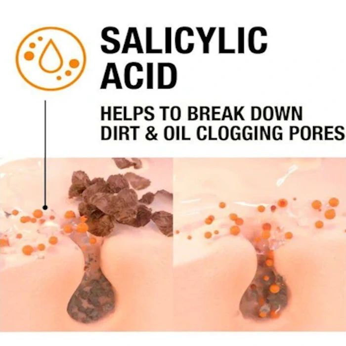 ژل شستشوی ضد جوش صورت نوتروژینا مدل Sivilce karsiti حجم 200 میل