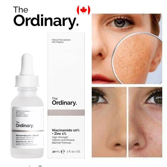 سرم ضد جوش نیاسینامید 10% + زینک 1% اوردینری اصل حجم 30 میلی لیتر