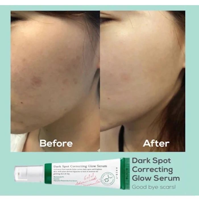 سرم ضد لک و روشن کننده حاوی نیاسینامید دارک اسپات کورکتینگ گلو اکسیس وای
