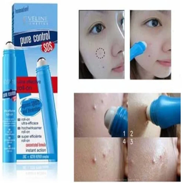 رول ضد جوش فوری اولاین